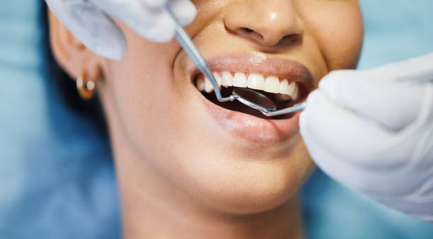 Best Same-Day Emergency Dentist in Cibecue, AZ