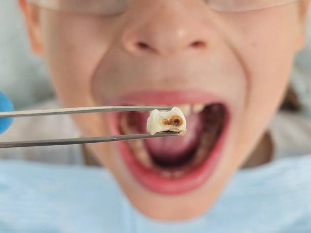 Best Emergency Dental Care for Trauma or Injury in Cibecue, AZ